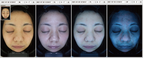 長寿命のLED光源を採用４つの光と安定した光量で複合分析を行います。