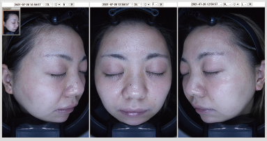 正面、左右側面の3面を撮影可能です。