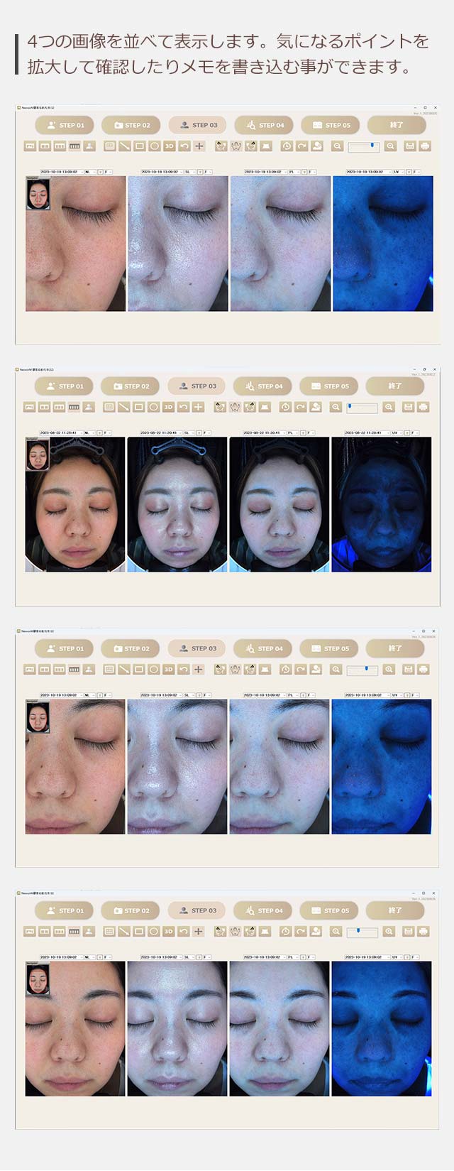 4つの画像を並べて表示します。気になるポイントを拡大して確認したりメモを書き込む事ができます。