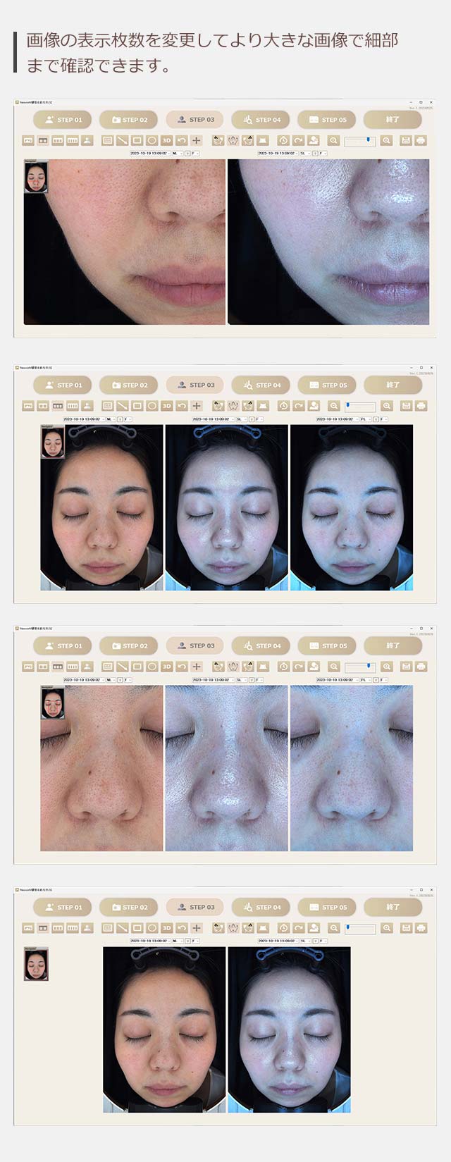 画像の表示枚数を変更してより大きな画像で細部まで確認できます。