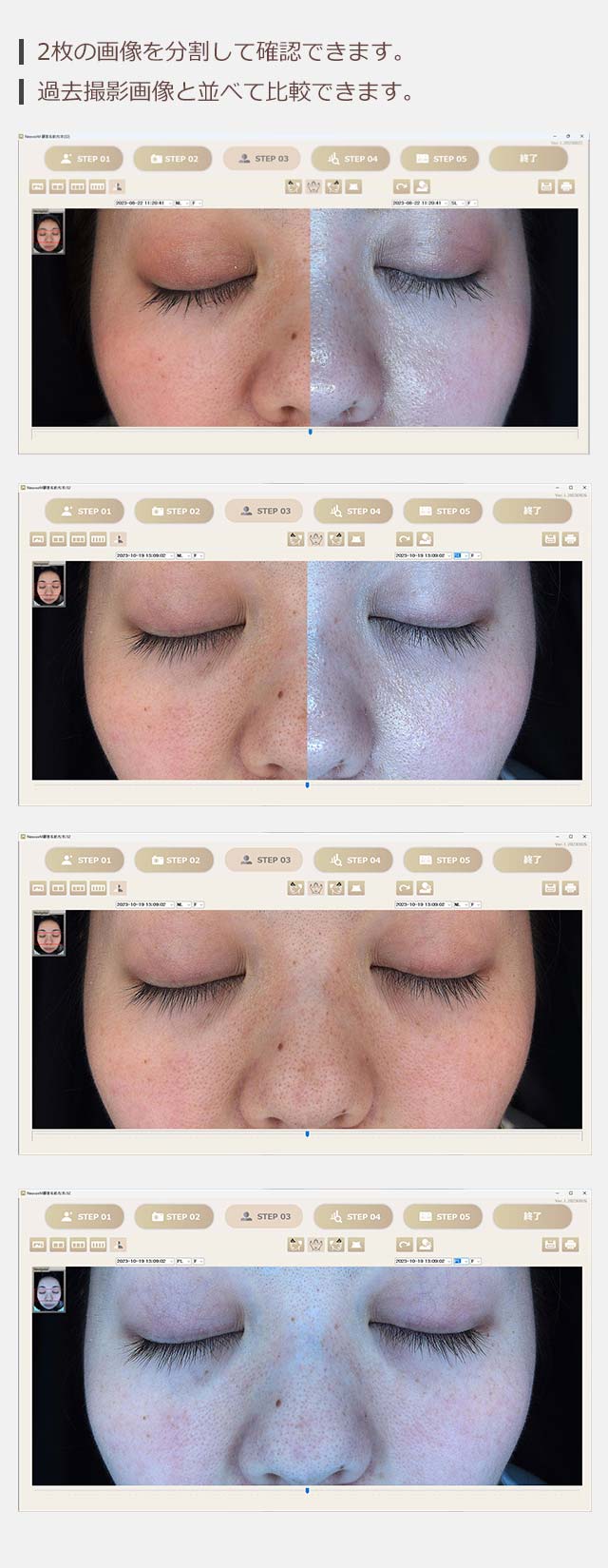 2枚の画像を分割して確認できます。過去撮影画像と並べて比較できます。