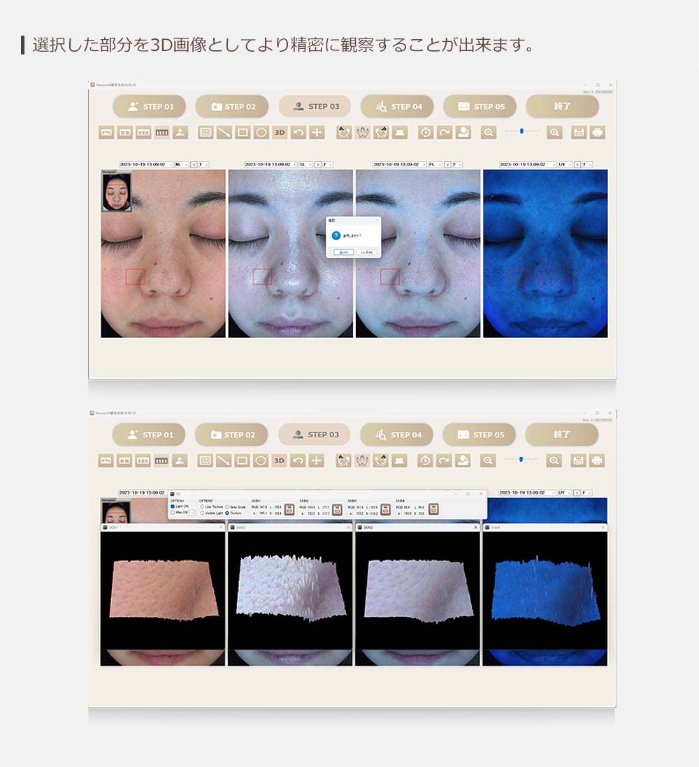 選択した部分を3D画像としてより精密に観察することができます。