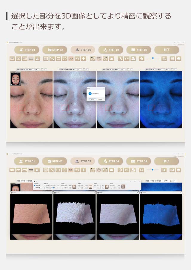 選択した部分を3D画像としてより精密に観察することができます。