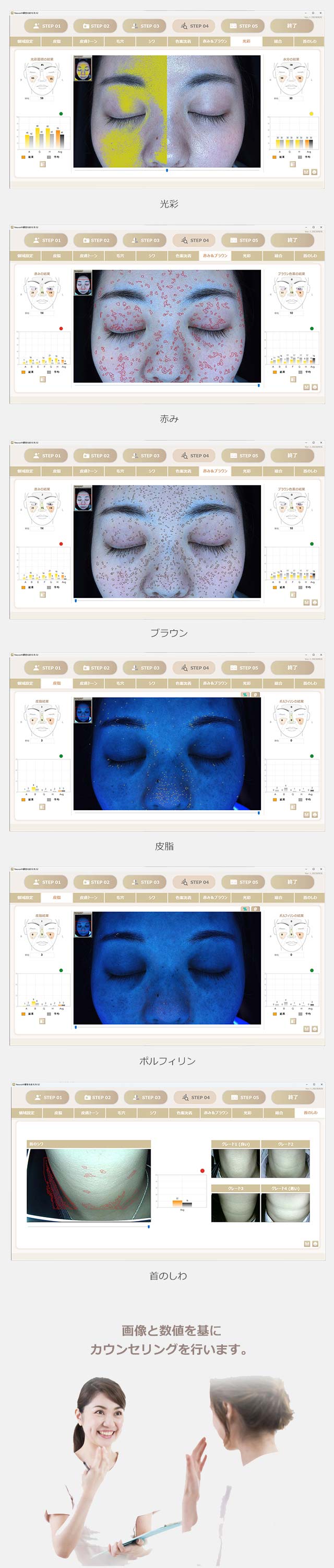 画像と数値を基にカウンセリングを行います。