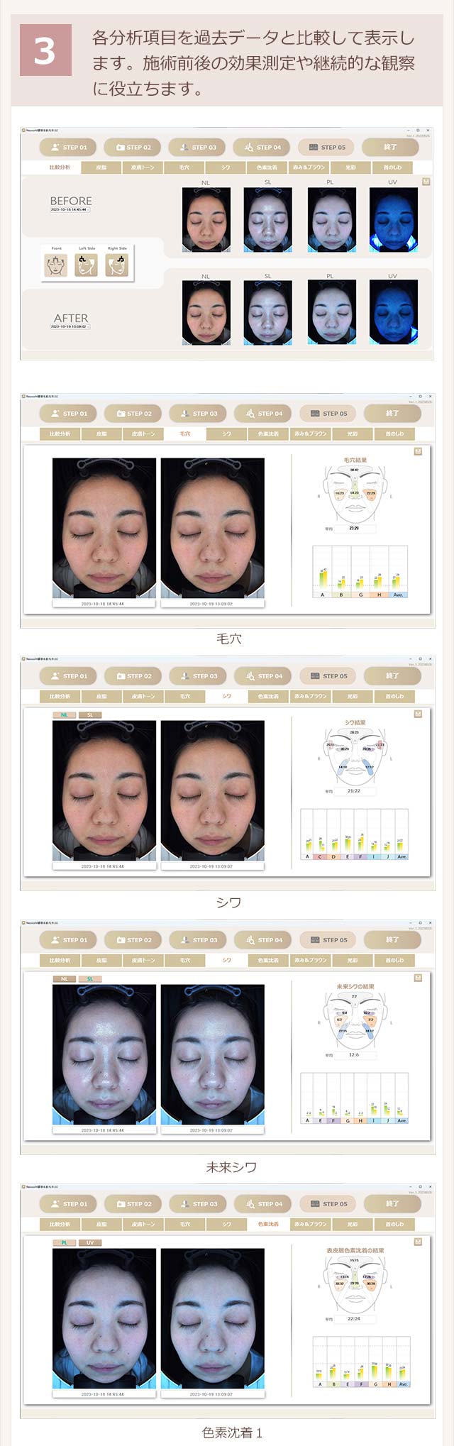 各分析項目を過去データと比較して表示します。施術前後の効果測定や継続的な観察に役立ちます。