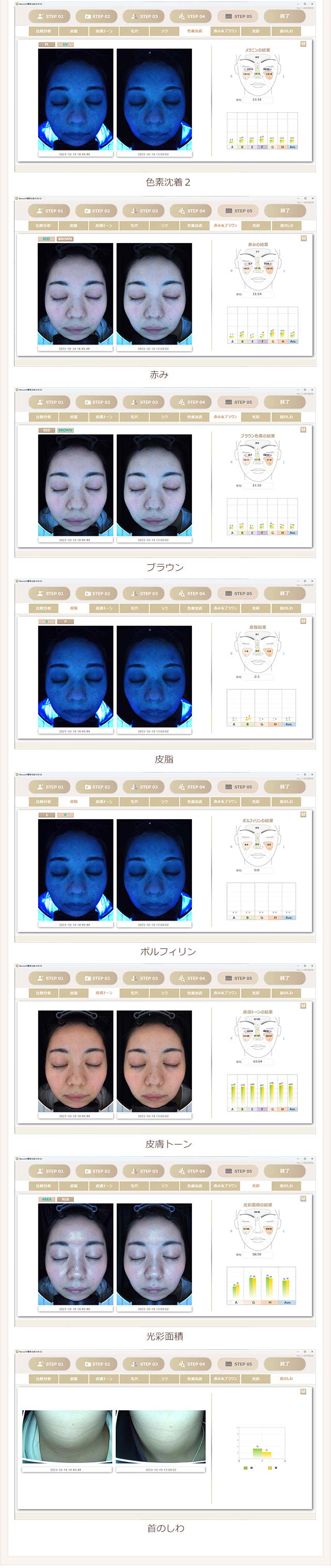 各分析項目を過去データと比較して表示します。施術前後の効果測定や継続的な観察に役立ちます。